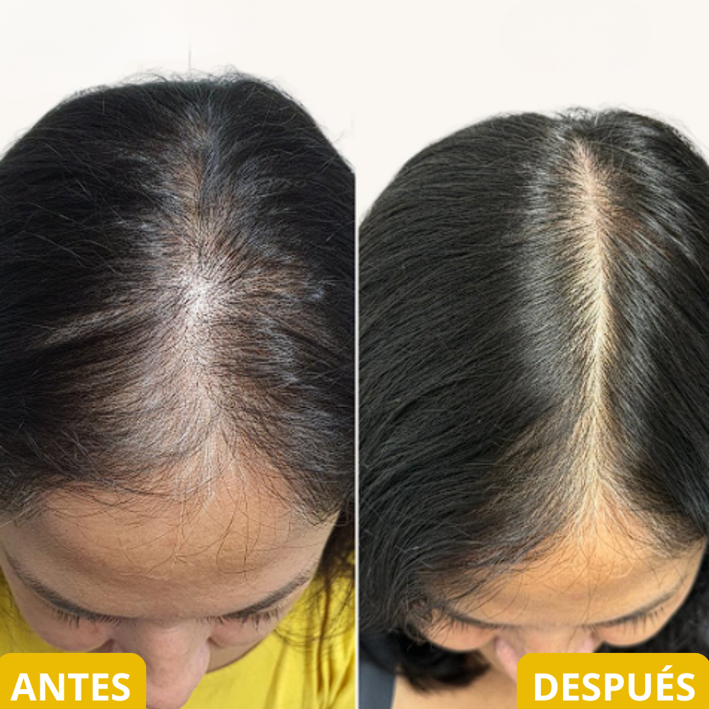 <p>Resultados reales en Mujeres reales… +35.000 <strong>Testimonios Verificados lo Respaldan</strong></p>
